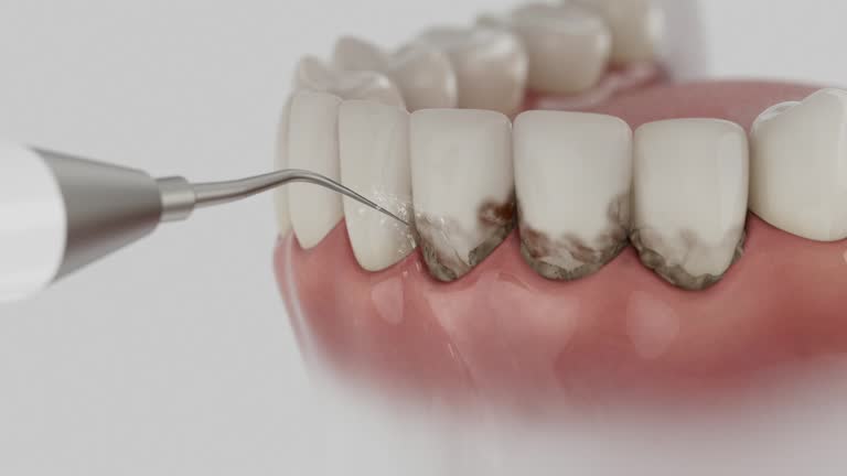 Reliable Dental Implants contractor in Northvale, NJ by Smile Center Dentistry
